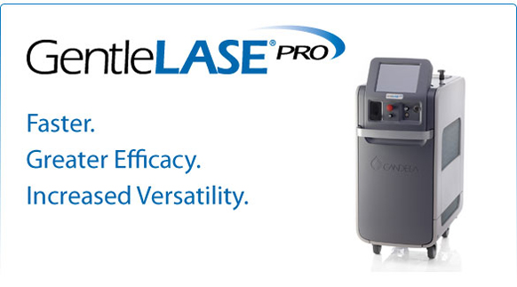 Gentlelase Laser Hair Removal Systems
